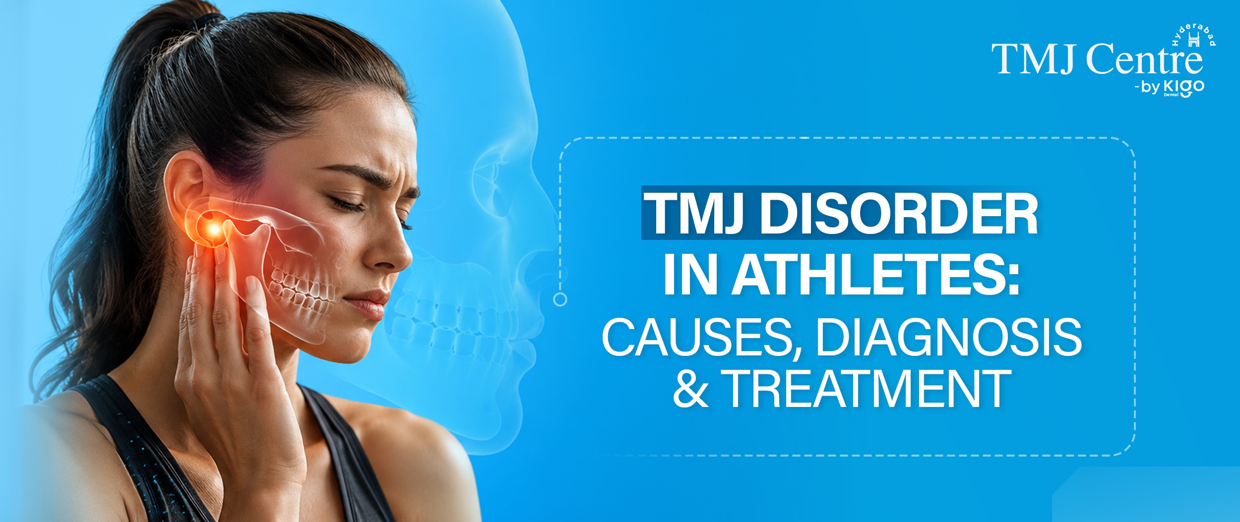 TMJ Treatment for Athletes