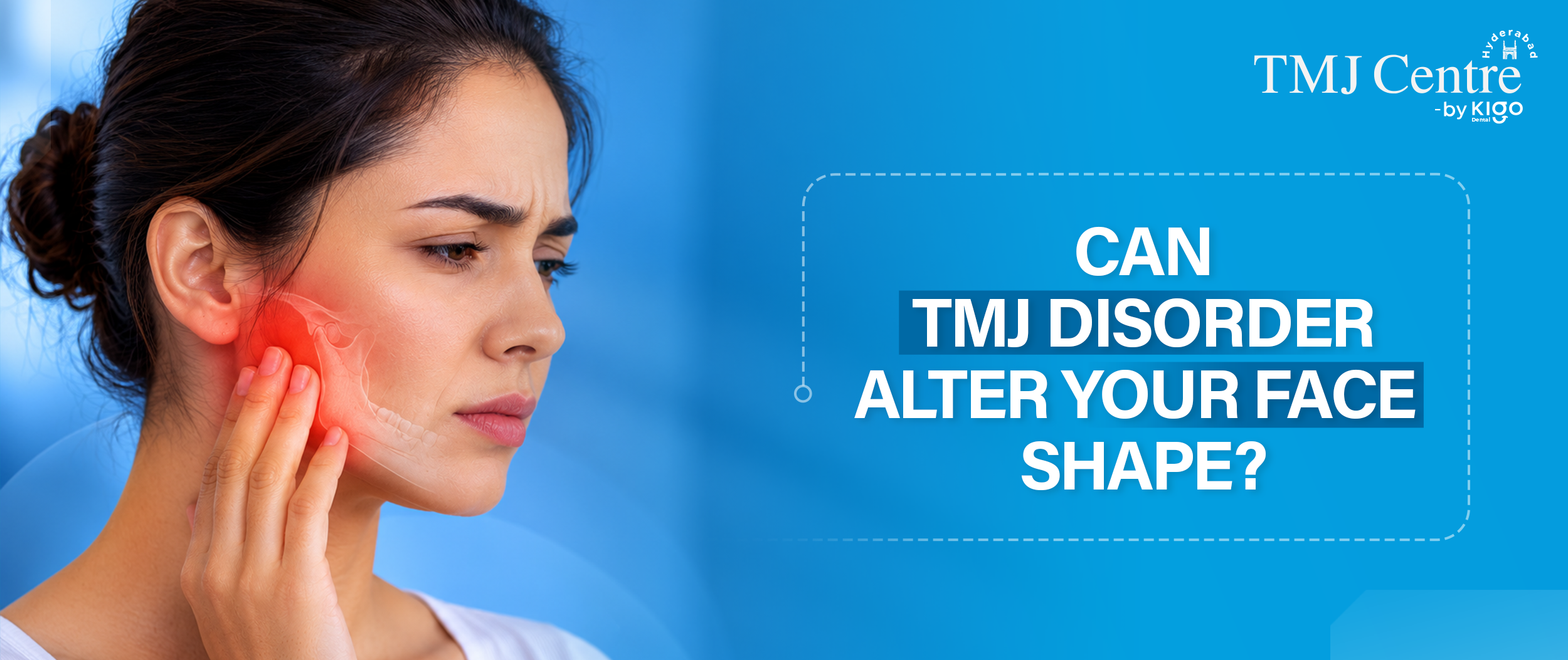 TMJ Disorder Treatment in Hyderabad
