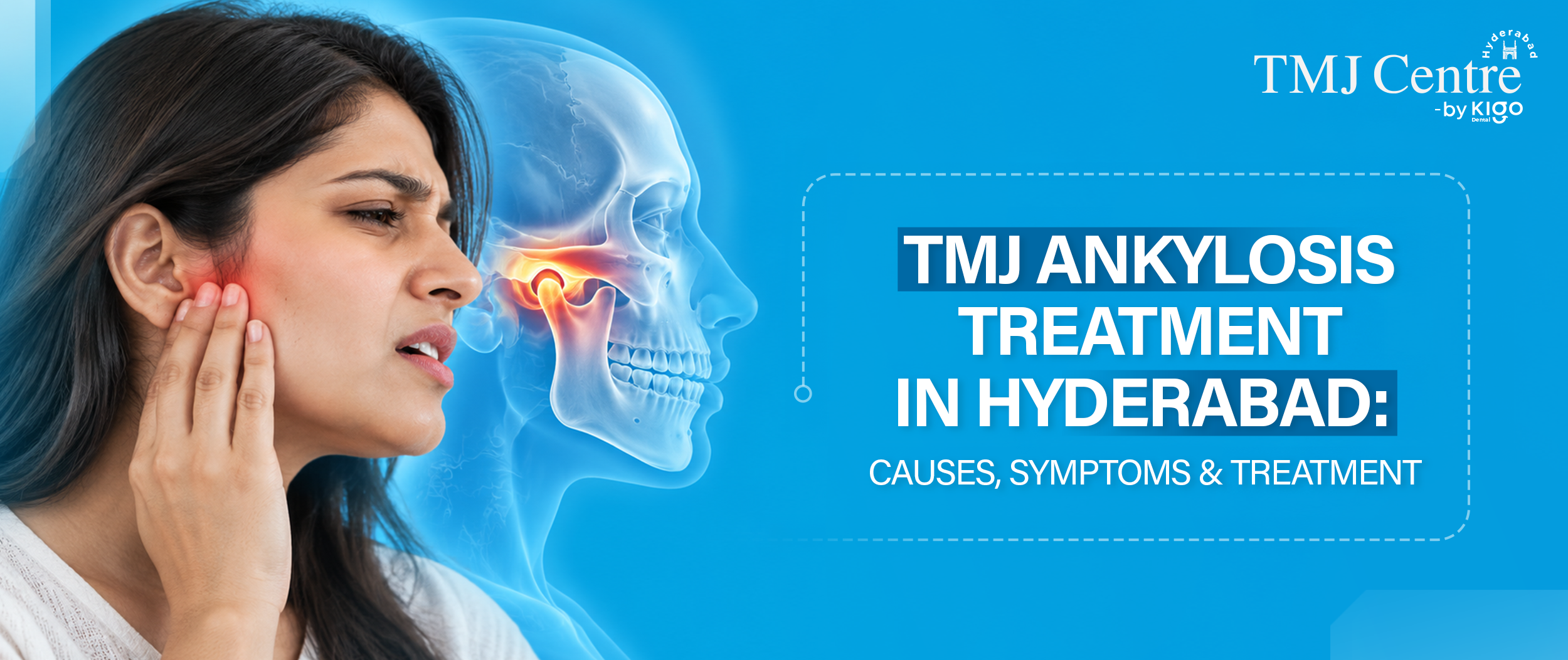 TMJ Ankylosis Treatment in Hyderabad